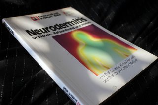 Neurodemitis - Ursachen Behandlung und Hilfen Prof. Dr. med. Klaus Harnack